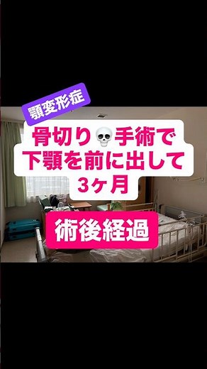 下顎を前に出した手術から3ヶ月‼️術後経過🦷#顎変形症 #顎変形症患者 #骨切り手術 #健康習慣 #shorts #患者記録