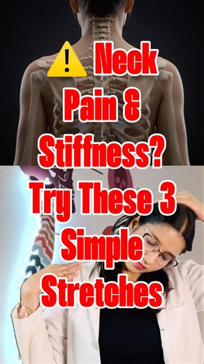 🔥 3 Best Neck Stretches for Neck Pain & Stiffness | Physiotherapist Recommended