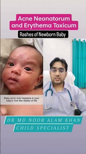 Rashes of Newborn Baby | Erythema Toxicum and Acne Neonatorum | Dr Md Noor Alam
