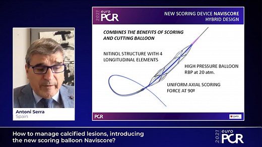How to manage calcified lesions, introducing the new scoring balloon Naviscore?