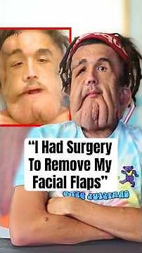 "I Had Surgery To Remove My Facial Flaps” #shorts #Neurofibromatosis #RareCondition