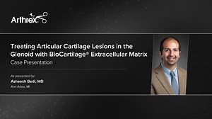 Treating Articular Cartilage Lesions in the Glenoid with BioCartilage® Extracellular Matrix