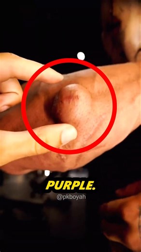 Do you think this guy is actually using 💉… or is something else going on here 🤔 @genet1canomaly