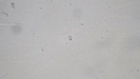 clip-4001593529-fast-moving-protozoan-under-2000x-brightfield-microscopy-using