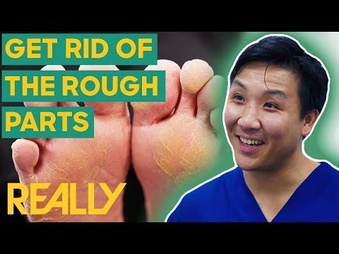 Treating Bad-Looking Feet To Look Healthy Again | The Bad Foot Clinic | Brand New Series