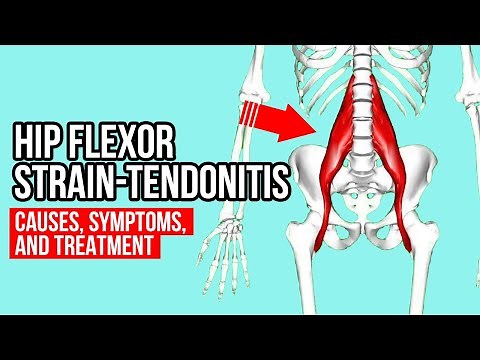 Hip Flexor Strain-Tendonitis? Causes, Symptoms, And Treatment
