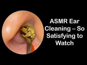 ASMR Ear Cleaning So Satisfying to Watch