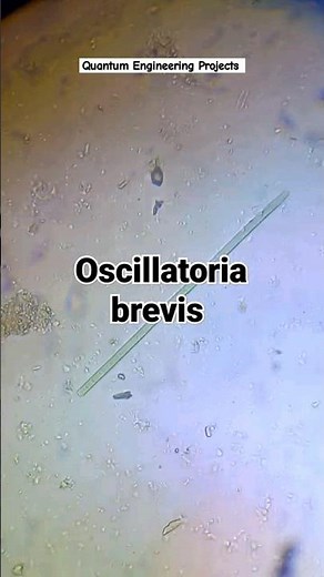 Cyanobacteria: Oscillatoria brevis under microscope | Microscopic world | bacteria | biology