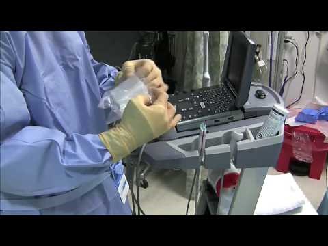 Sterile Sheath for Ultrasound Guided Procedure: Single Operator Technique
