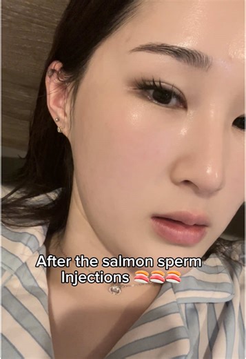 Rejuran Skin Treatment: Benefits and FAQs Explained