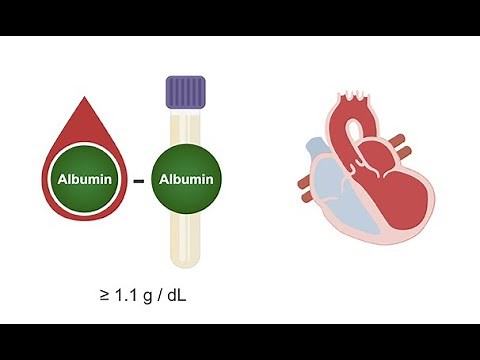 Analyzing the cell count and protein concentration in ascites