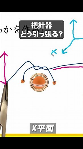 持針器の引っ張り方とは？？