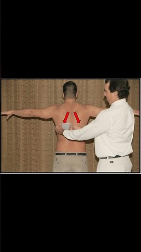 🦴 Lateral Scapular Slide Test Explained #shoulderpain #meded #ortho #ATC #physio