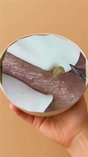 #squeeze #squeezeyuk