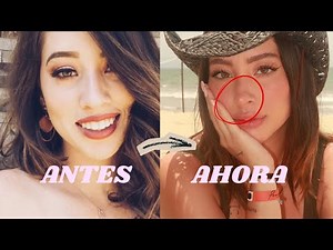 SMALL, UPTURNED NOSE WITHOUT SURGERY! Complete FACIAL YOGA ROUTINE AT HOME 🤩