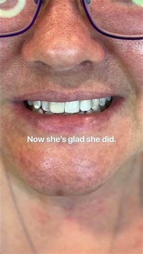 Do You Have White Spots On Your Teeth? Here's The Fix! 💎