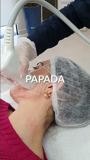 O Hipro já chegou na Fisioforma! 💙#rejuvenescimentofacial #rejuvenescimento #hipro