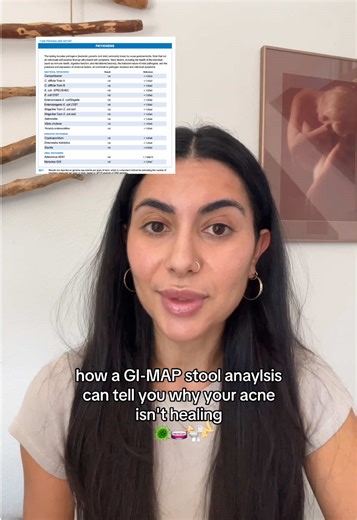 Unlocking Acne Healing with GI-MAP Stool Analysis