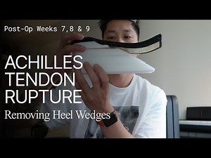 Weeks 7,8 & 9 - Achilles Tendon Rupture - Operative Repair Surgery - Removing Heel Wedges