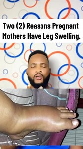 Why you have swollen legs during pregnancy. #pregnancy | Dr.Moyub Healthcare