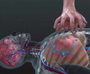 Check out this insightful video that demonstrates life-saving CPR techniques. Your knowledge could make a significant difference in an emergency. Let's spread awareness and empower our network to be… | Ravi Mishra | 32 comments