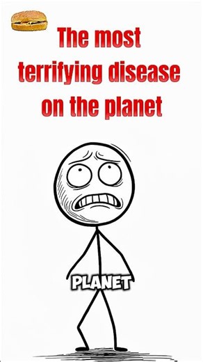 😱 This Disease Turns Muscles Into Bones