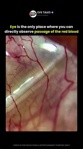The Eye Is the Only Place You Can See Blood Flow Directly 😳👁️