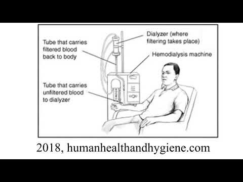 What are Hemodialysis and Peritoneal Dialysis?