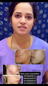 9.7K views · 158 reactions | Sasi Pure Cosmetics Review | Periyanayaki M D | Facebook