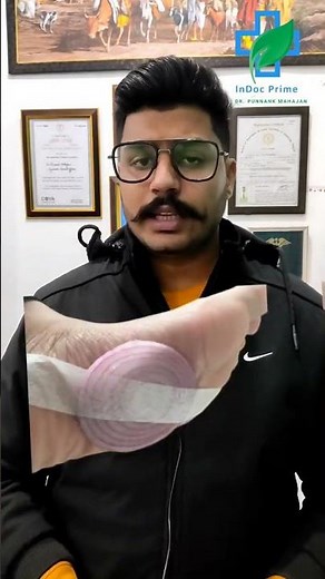 बालतोड़, फोड़ा, फुंसी ठीक करें एक रात में। Home Remedies for Boil InDocPrime #medical #shorts