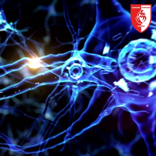 10K views · 76 reactions | [JOURNÉE MONDIALE DE L’AVC] 易L’Accident...