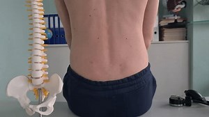 Rear view of a teenage boy with a straight back and spine. Human spine and anatomy and vertebrae
