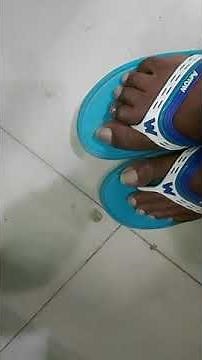 thalamic hand and foot