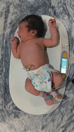 Newborn Head to Toe Assessment in NICU _ Weight _ RBS Monitoring _ Complete Neonatal Care Guide #newborn #preterm #babycare #usa #unfreezmyaccount