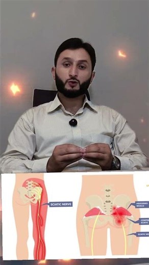 Piriformis Syndrome can cause pain in your hip.