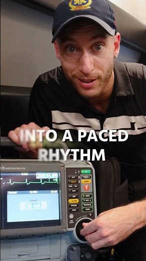 Pacing a Complete Heart Block