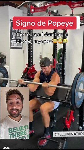 Signo de Popeye: Desgarro del Tendón del Bíceps