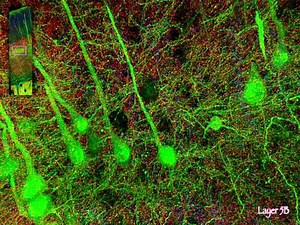 Human brain has more switches than all computers on Earth