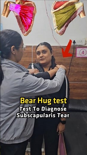 🤯 Test to Diagnose Subscapularis Tear | Physiotherapy Test #physiotherapy #aprc #shouldertear