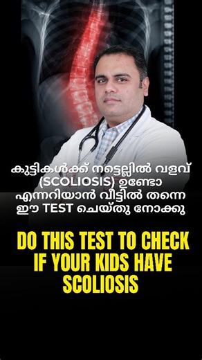 Dr Shine Mohaan T | Scoliosis, Spine, Posture Rehab Specialist | കുട്ടികൾക്ക് നട്ടെല്ലിൽ വളവ് (Scoliosis) ഉണ്ടോ എന്നറിയാൻ വീട്ടിൽ തന്നെ ഈ test ചെയ്തു നോക്കു 👆 Do this simple test to know if your child... | Instagram