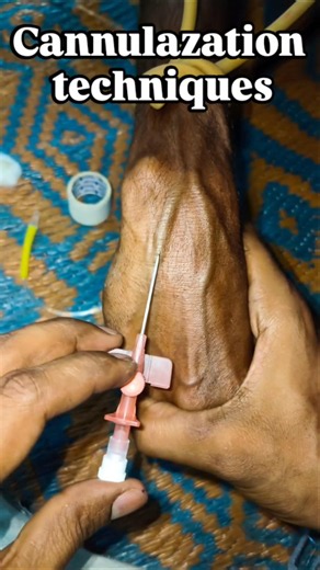 IV Cannulation Made Easy | Clinical Nursing Procedure #medicaleducation #cannulation #nursingstudent