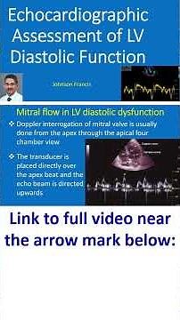 Echocardiographic Assessment of LV Diastolic Function