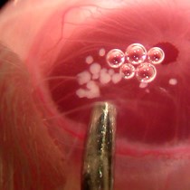 Video: Longitudinal In Vivo Imaging and Quantification of Human Pancreatic Islet Grafting and Contributing Host Cells in the Anterior Eye Chamber