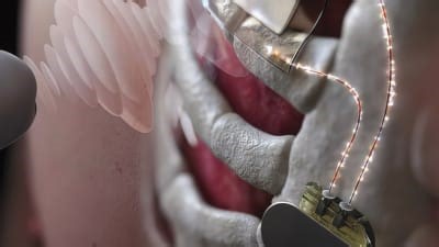 Ultrasound as a New Wireless Power Transfer Technology