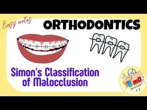 Simon's classification of Malocclusion- Orthodontics - BDS