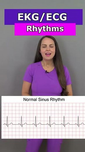 ECG EKG Heart Rhythms Nursing #shorts (afib, vtach, bradycardia, sinus rhythm, aflutter)