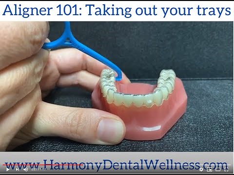Taking out your Invisalign Trays: Aligner 101