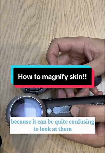Understand Dermatoscope Use for Skin Examination