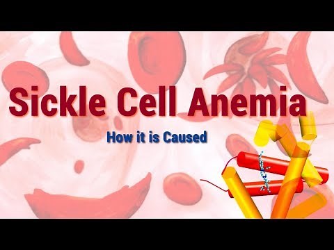 Sickle Cell Anemia | Causes, Symptoms and Molecular Mechanism