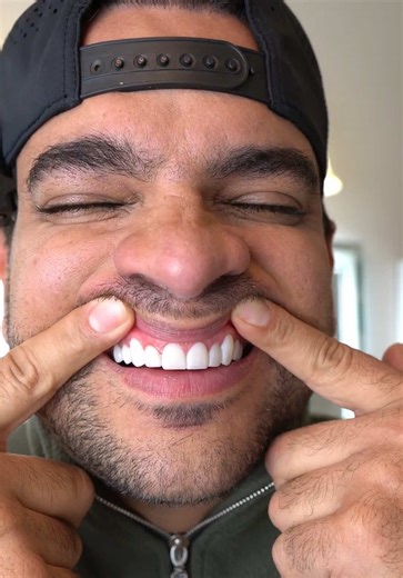 La mejor solución sin duda para blanquear los dientes y matar esa sensibilidad a lo frío y lo caliente #pastadental #hidroxiapatita #toothpaste #dentalhealth